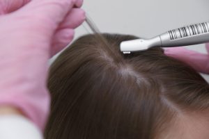 Фототрихограмма волос: инновационный метод диагностики и ухода за волосами